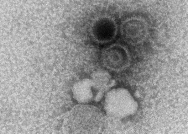 Epstein-Barr virus