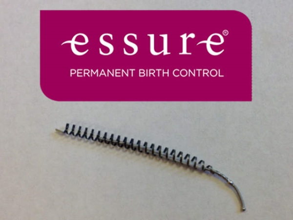 Essure Permanent Birth Control