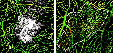 Blood vessels