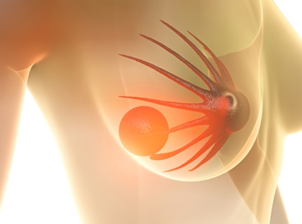 The FDA approved Kisqali for treatment of certain breast cancers
