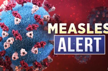 Measles Alert, measles cases