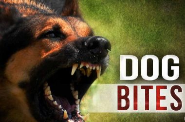 dog bites, dog bit child